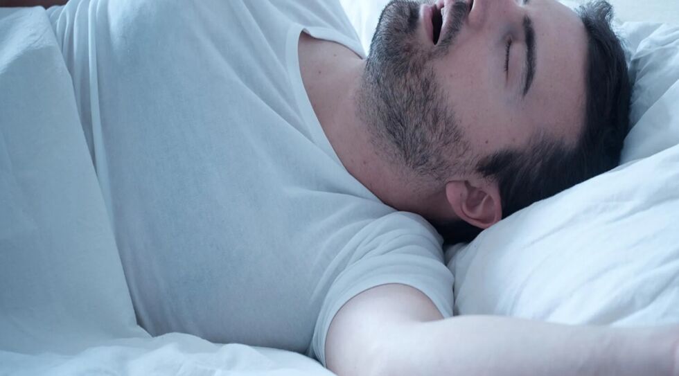 Apnée obstructive du sommeil | Chirurgie de l'apnée du sommeil